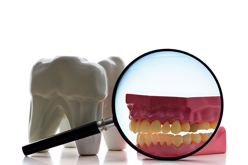 Root Canal - Two Rivers Dental, Bolingbrook Dentist